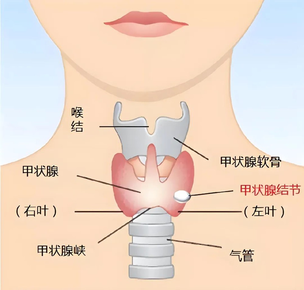 甲状腺结节的中医治疗，您知道多少？